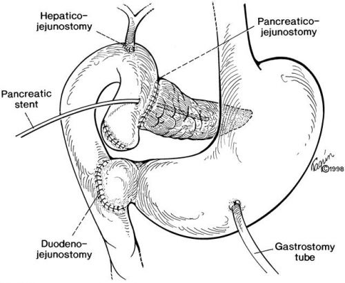 pancreas beeld