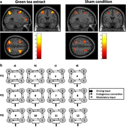 MRI scans hersenen groene thee extract