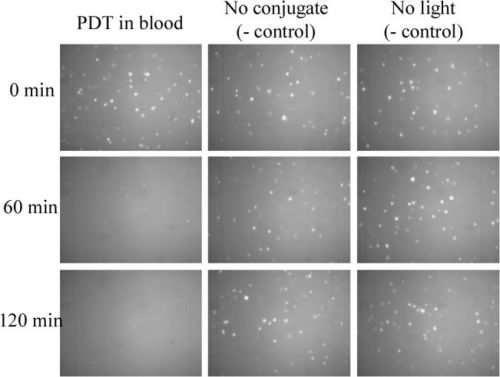 PDT van circulerende tumors in bloed 3