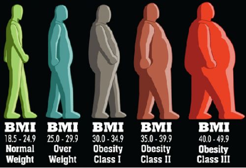 obesitas BMI