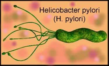 bacterie h pylori